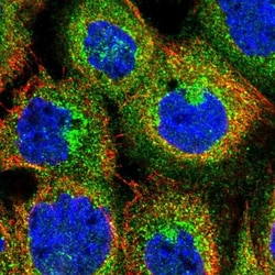 DENND4C Antibody, Novus Biologicals 25 &mu;L; Unlabeled:Antibodies, Polyclonal
